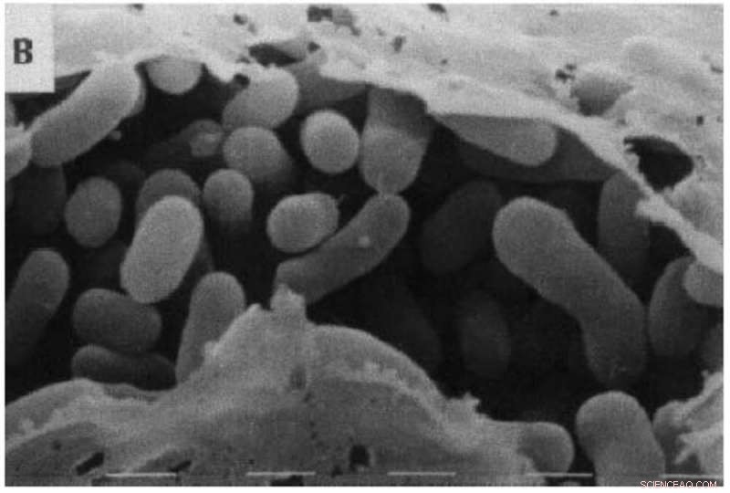 Microbes May Govern the Planet’s Largest Greenhouse Gas Reserves