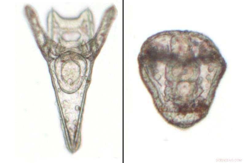 How Plastic Contaminants Damage Sea Urchin Development