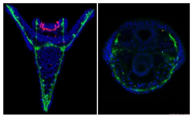 How Plastic Contaminants Damage Sea Urchin Development