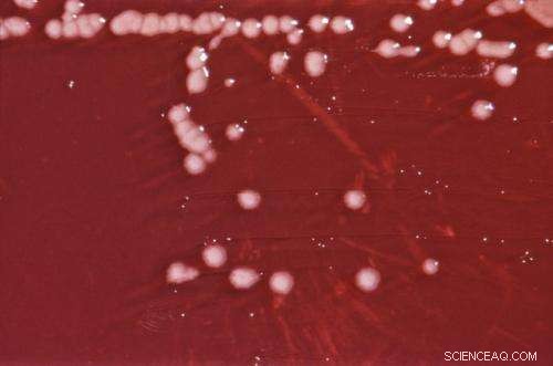 Bacteria Selectively Metabolize Carbon Sources Under Iron-Deficiency