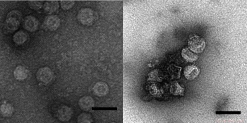 Standard Water Treatment Effectively Removes and Inactivates Enveloped Viruses