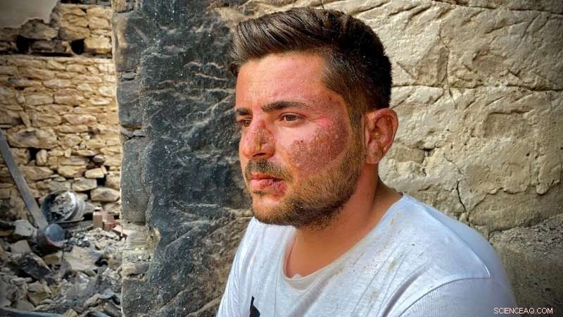 Turkey Wildfires: Eight Fatalities Reported in Latest Outbreak