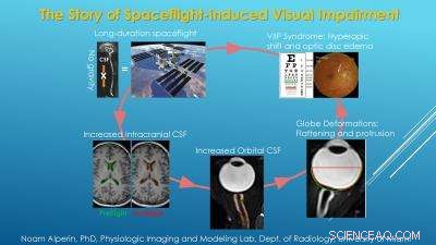Groundbreaking Study Reveals Cause of Visual Impairment in Long-Duration Space Missions