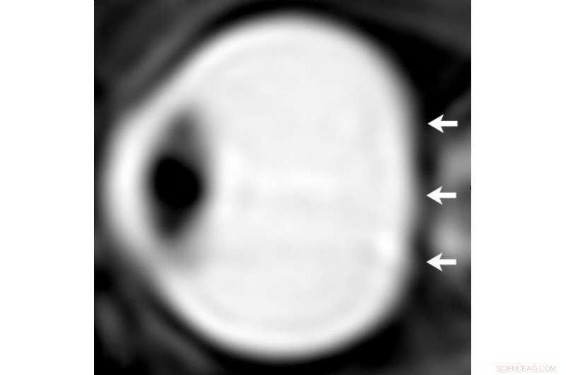 Groundbreaking Study Reveals Cause of Visual Impairment in Long-Duration Space Missions