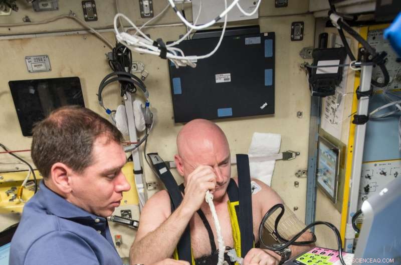 NASA Study Links Genetic Markers to Vision Issues in Space Mission