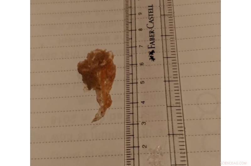 Candy-Pink Lagoon Reveals Salt‑Rich Habitat That Could Support Life on Mars