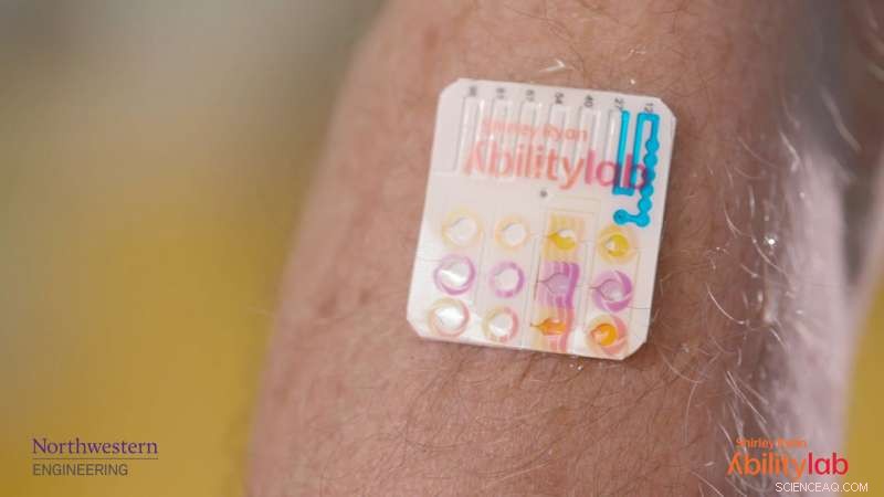 Stretchable Electronics: A Game-Changer in Stroke Rehabilitation