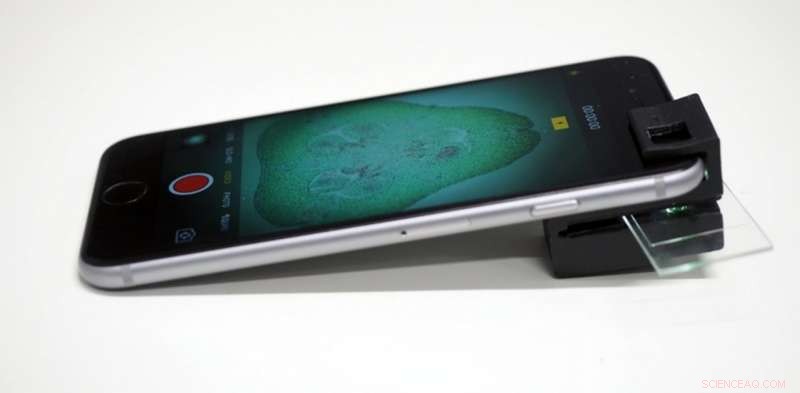 Transform Your Phone Into a Microscope: Our 3‑D Printable Clip‑On Design