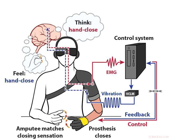 Enhanced Prosthetic Hand via Muscle Vibration Feedback