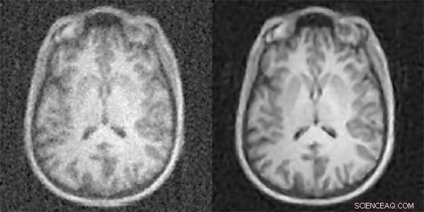 Revolutionary AI Technique Enhances Medical Imaging Quality and Reduces Patient Exposure