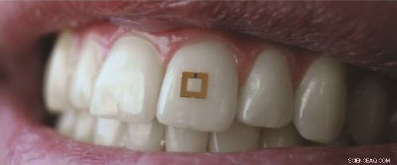 Scientists Invent 2×2 mm Tooth-Mounted Sensors to Monitor Your Food Intake in Real Time
