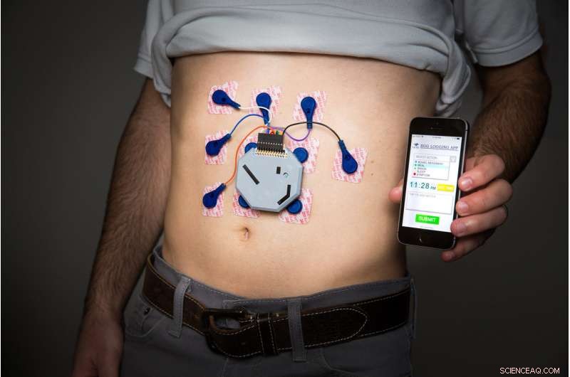Wearable Device Enables Continuous Monitoring of Stomach Activity