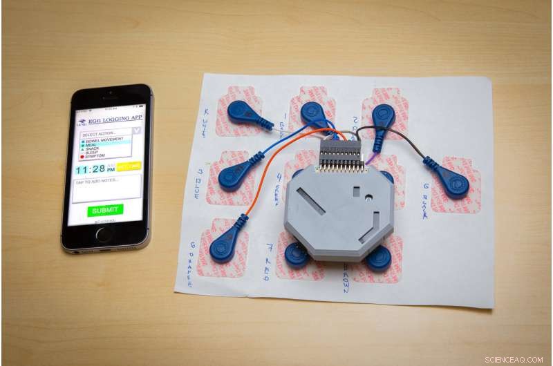 Wearable Device Enables Continuous Monitoring of Stomach Activity