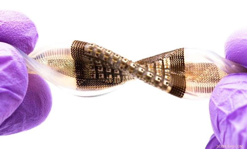 Innovative Flexible Ultrasound Patch Enhances Damage Inspection in Complex Structures