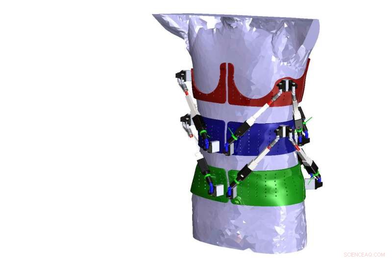 Revolutionary Dynamic Spine Brace: Robotic Exoskeleton Diagnoses Spinal Deformities
