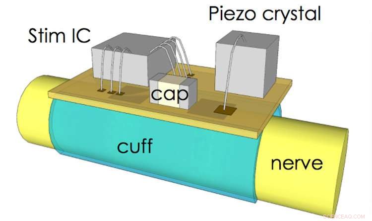 New Ultrasonic Nerve Stimulator Sets Record for Smallest Volume and Highest Efficiency