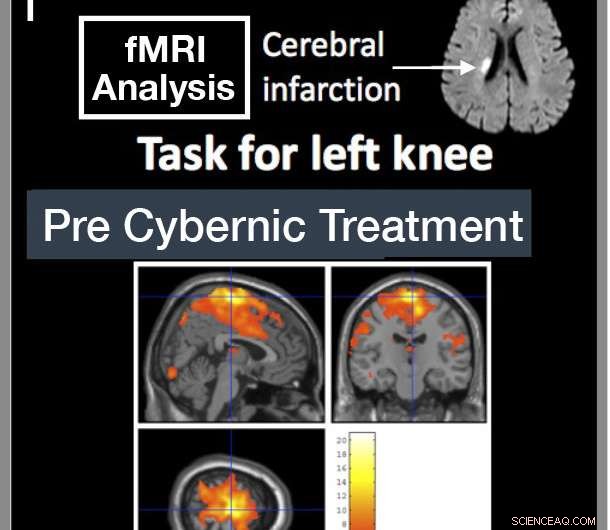 Researchers Reveal Exoskeletons Evolve to Embrace the Spirit of Sci‑Fi
