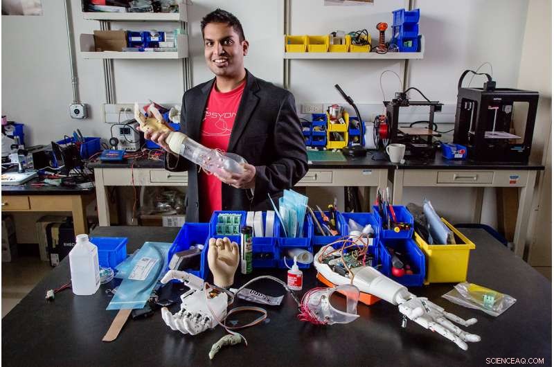 New Study Shows Prosthetic Arms Deliver Precise Sensory Feedback
