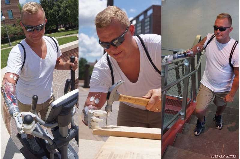 New Study Shows Prosthetic Arms Deliver Precise Sensory Feedback