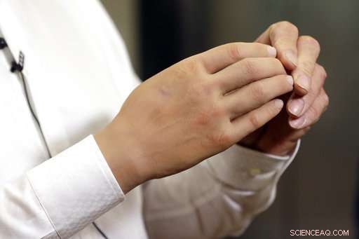 Italian Scientists Unveil Lighter, Affordable Robotic Hand to Enhance Amputee Grip