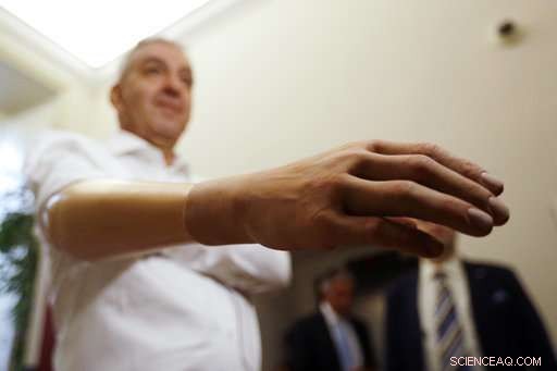 Italian Scientists Unveil Lighter, Affordable Robotic Hand to Enhance Amputee Grip
