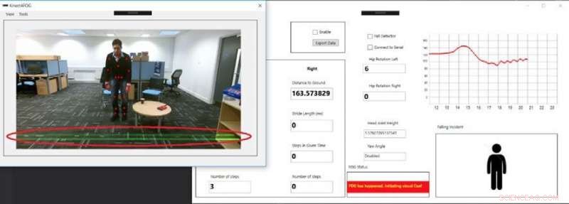 Revolutionary Kinect System Enhances Mobility for Parkinson’s Patients