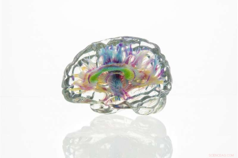 Revolutionizing Anatomy: Multimaterial Voxel Printing Converts Brain Imaging Data into Tangible 3D Models