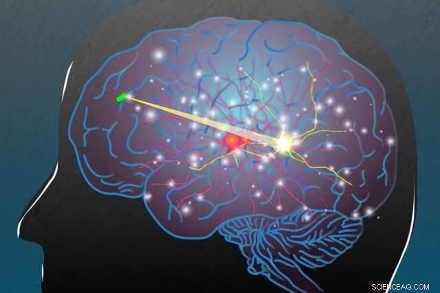 Wireless Power Delivery Enables In‑Body Devices