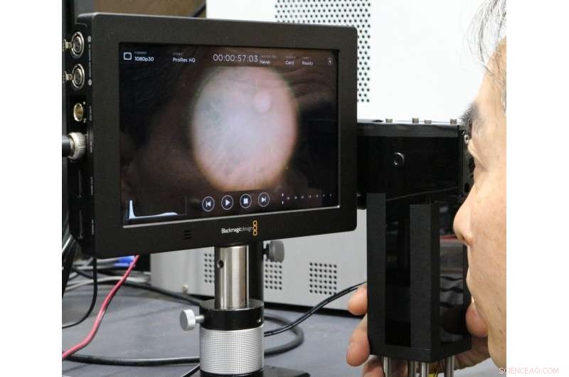 Compact Infrared Cameras Capture Colorful Eye Images for Early Disease Detection