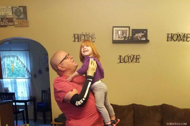 Advanced Prosthetic Hand Lets Amputee Hold Granddaughter Again
