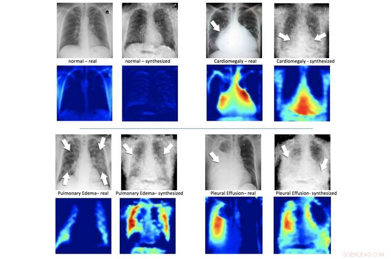 Boosting AI Accuracy with Synthetic X-ray Datasets