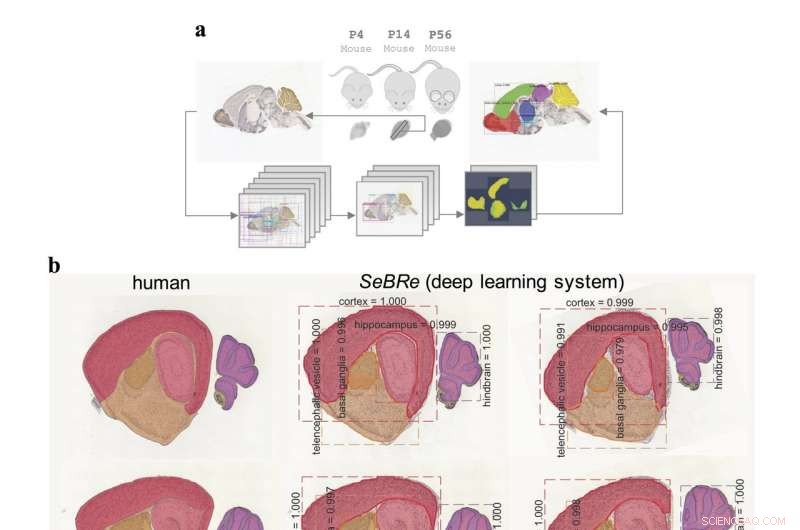 Building a Comprehensive Brain Atlas with Deep Learning Techniques