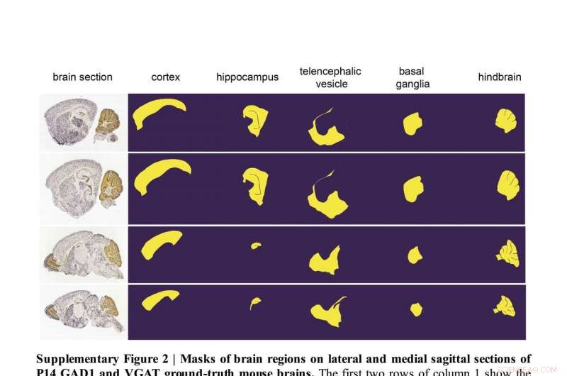 Building a Comprehensive Brain Atlas with Deep Learning Techniques