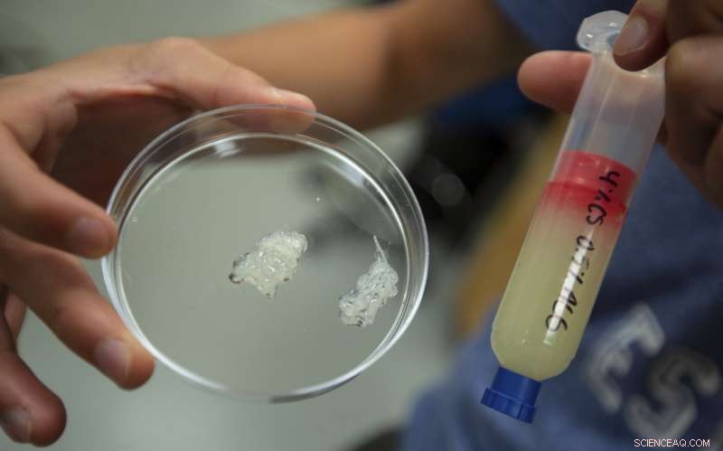 How 3‑D Printing Could Revolutionize Recovery for Shark Bite Victims