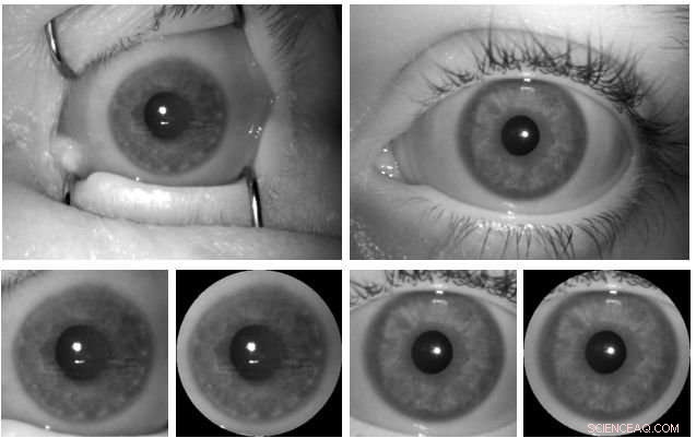 Warsaw Researchers Develop Reliable Cadaver Iris Detection Method