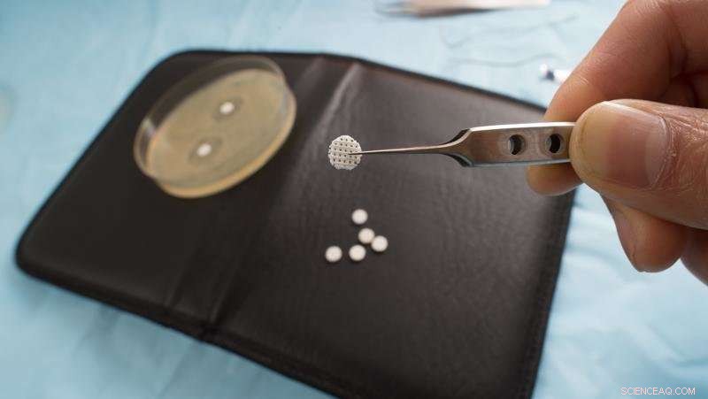 Tiny 3‑D Printed, Antibiotic‑Infused Scaffolds Offer New Defense Against Superbug Infections