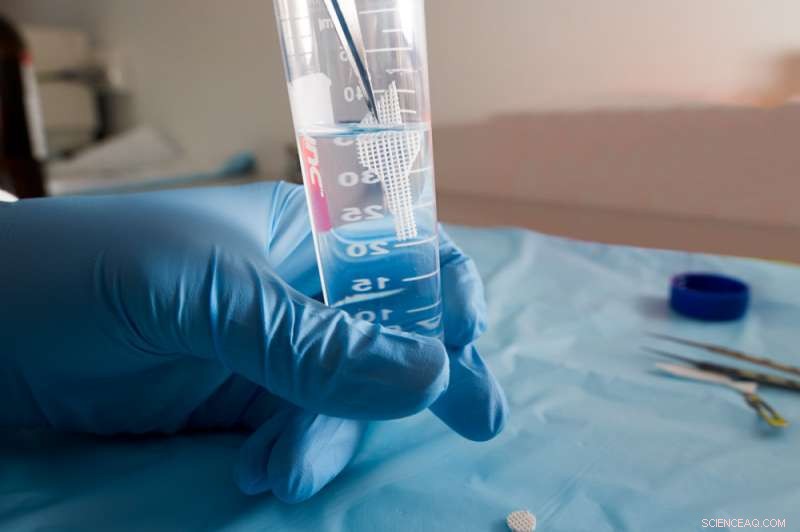 Tiny 3‑D Printed, Antibiotic‑Infused Scaffolds Offer New Defense Against Superbug Infections