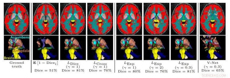 Advancing Medical Image Analysis Through Deep Learning