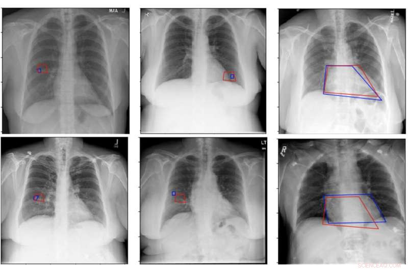 Advancing Medical Image Analysis Through Deep Learning