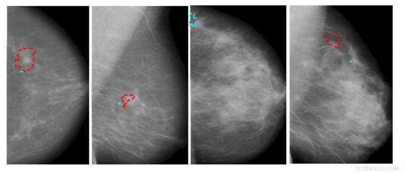 Advancing Medical Image Analysis Through Deep Learning