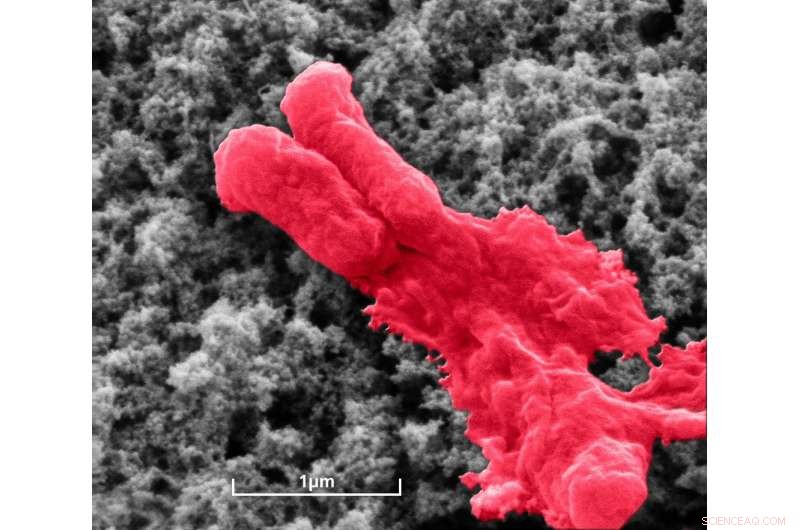 Bacteria Cannot Thrive on Antimicrobial-Coated Implants