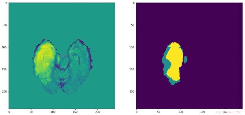 ColorUNet: Advanced Deep CNN Method for Image Colorization
