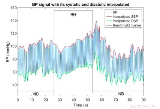Accurate Arterial Blood Pressure Estimation via Photoplethysmography-Based Mathematical Modeling