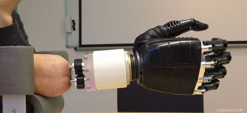 New Artificial Joint Restores Natural Wrist Motion for Forearm Amputees