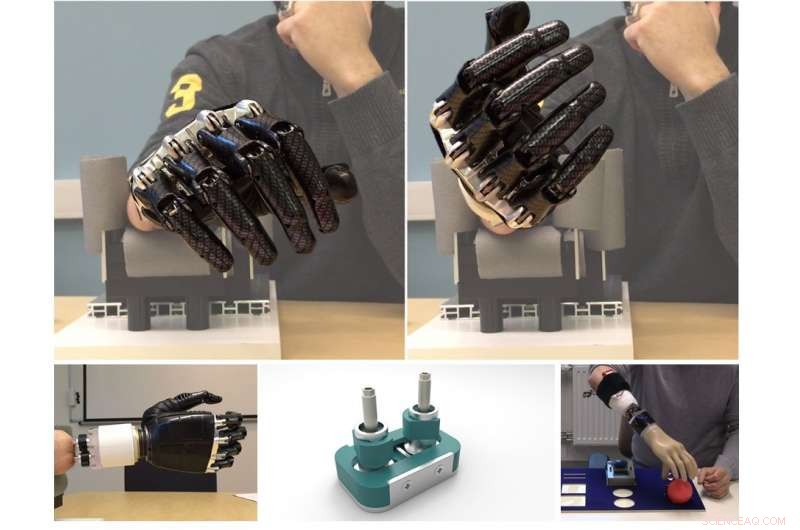 New Artificial Joint Restores Natural Wrist Motion for Forearm Amputees