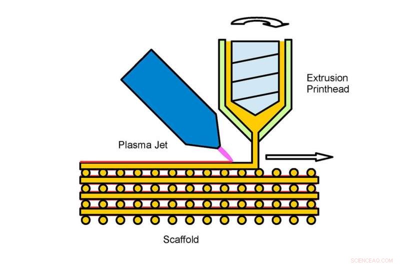 Custom 3D-Printed Bone Implants: Precision, Fit, and Innovation
