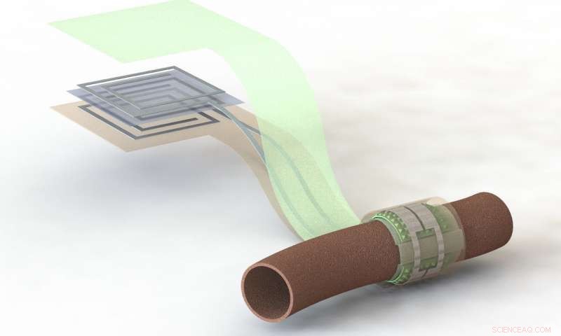Stanford Researchers Develop Wireless, Battery‑Free, Biodegradable Blood‑Flow Sensor