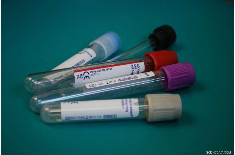 AI-Driven Insights: Cutting Blood Tests and Enhancing Care for ICU Patients