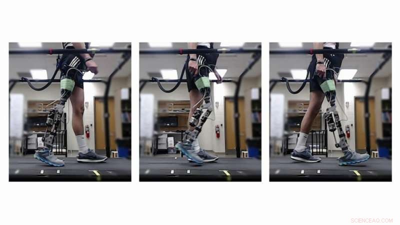 Accelerated Tuning of Powered Prosthetic Knees via Reinforcement Learning