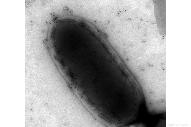 Advanced Software Boosts Food Safety Experts  Pathogen Testing